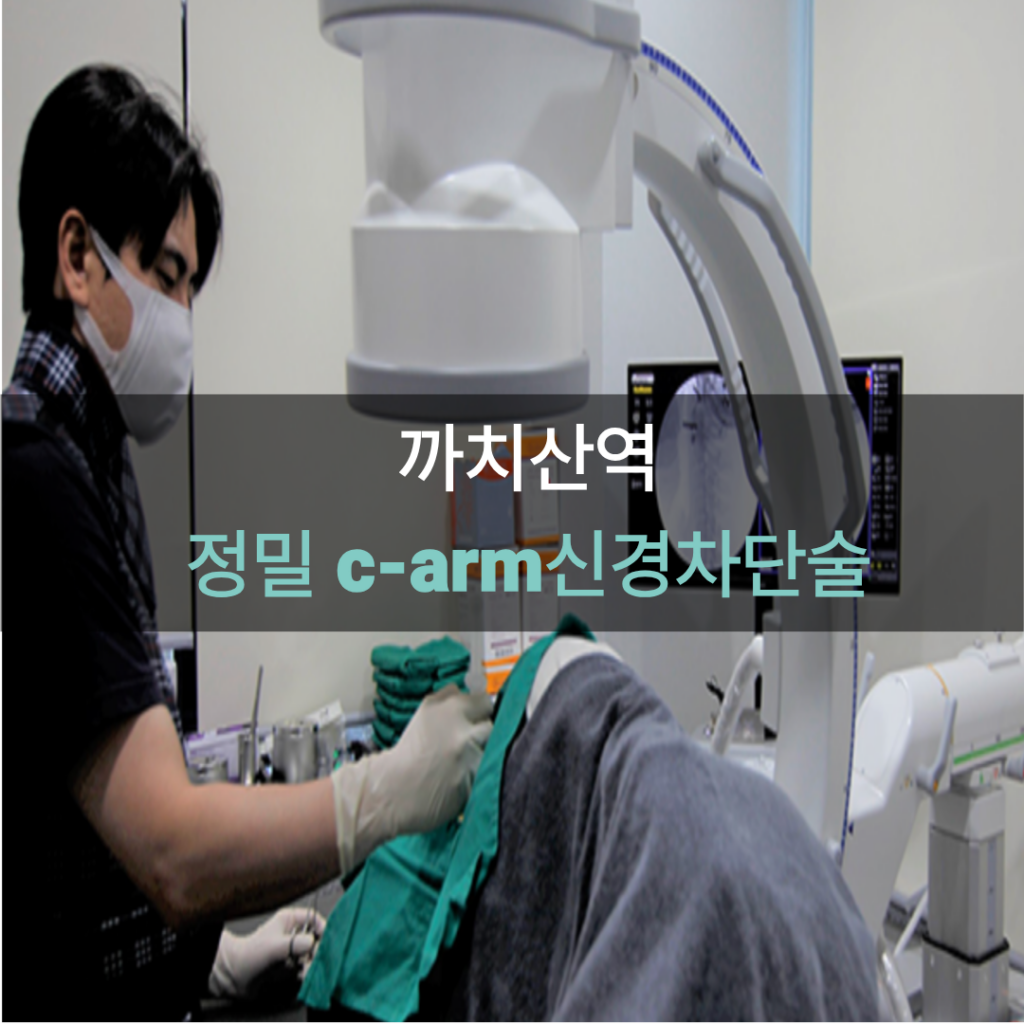 화곡역 정형외과 전문의 C-arm 영상 유도하 척추 신경차단술 비수술 치료 시술 장면